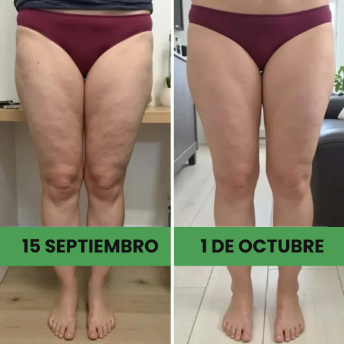 Pack 2×1 — Leggings 3D que moldean y reducen celulitis