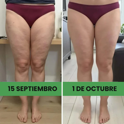 Pack 2×1 — Leggings 3D que moldean y reducen celulitis