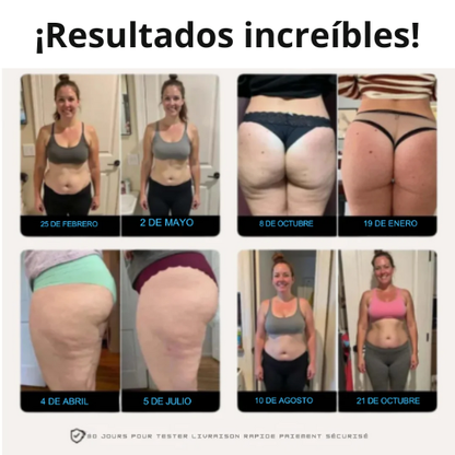 Pack 2×1 — Leggings 3D que moldean y reducen celulitis
