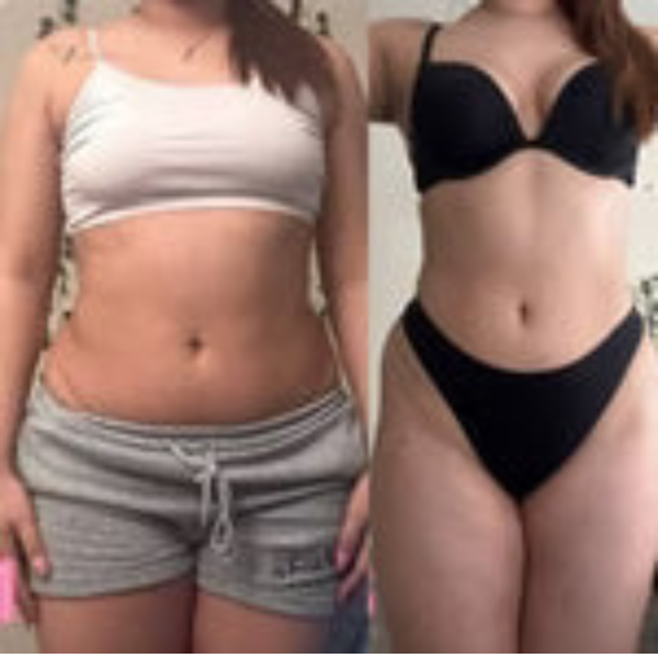 Gomitas De Vinagre De Manzana [Paga al recibir — Sin riesgo]