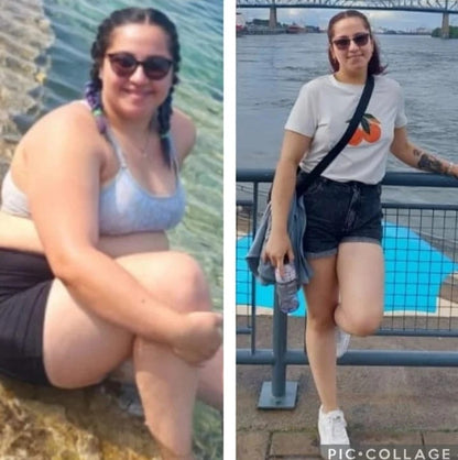 Gomitas De Vinagre De Manzana [Paga al recibir — Sin riesgo]