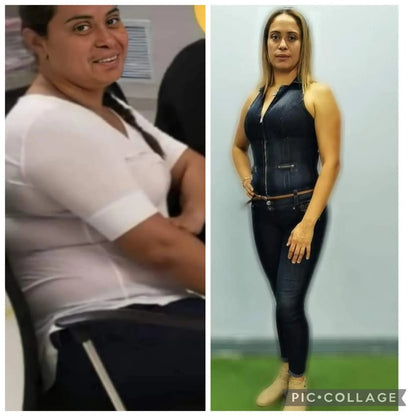 Gomitas De Vinagre De Manzana [Paga al recibir — Sin riesgo]